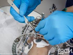 Высокие технологии самого древнего раздела медицины: Как работает травматологическая служба РБ№2 