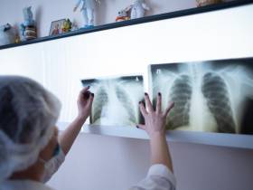 Врач-фтизиатр рассказала о профилактике туберкулеза в Якутии