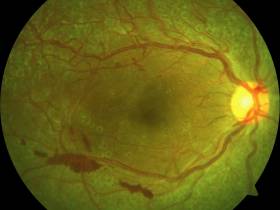 В Якутске откроется совместная выставка Миры Аргуновой и офтальмологической больницы