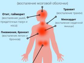 Свиной грипп распространился в Якутске и 23 районах республики