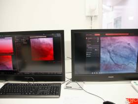 Якутский кардиоцентр спасает жизни и помогает улучшить качество медицинской помощи в республике