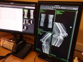 В Якутии разработают программу приёма пациентов с использованием искусственного интеллекта