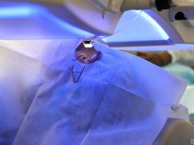 В Якутске более чем 50 пациентам провели лазерную коррекцию зрения на новом оборудовании