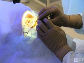 В Якутске более чем 50 пациентам провели лазерную коррекцию зрения на новом оборудовании